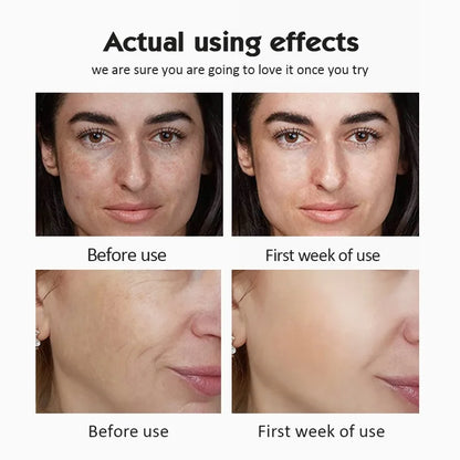 Vitamin C Ampoule Serum Set